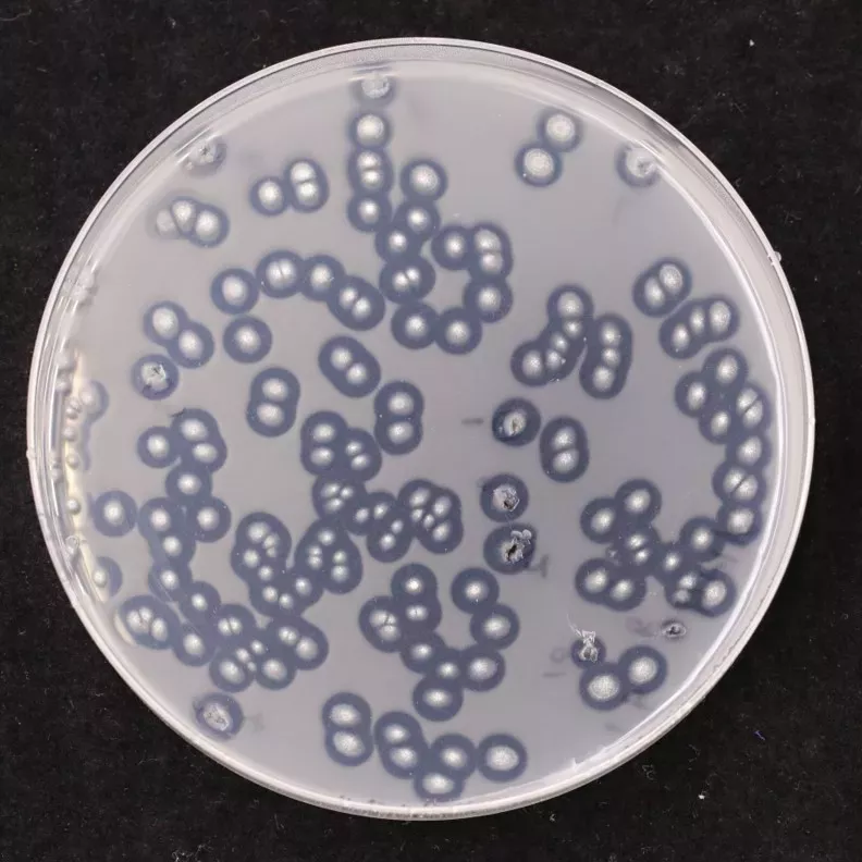 In this petri dish, each small dot is a growing region of fungus. The clear area around each spot contrasted against the opaque background shows where the microbe has digested the polycaprolactone surrounding it. © RBG Kew A petri dish contains multiple small white dots of fungus, each with a clear disk surrounding it where digestion of the surface is taking place